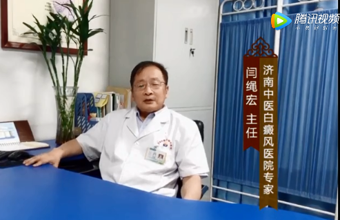 白癜风有什么危害？